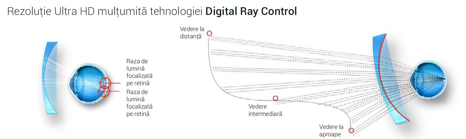 Digital Ray Ital-Lenti